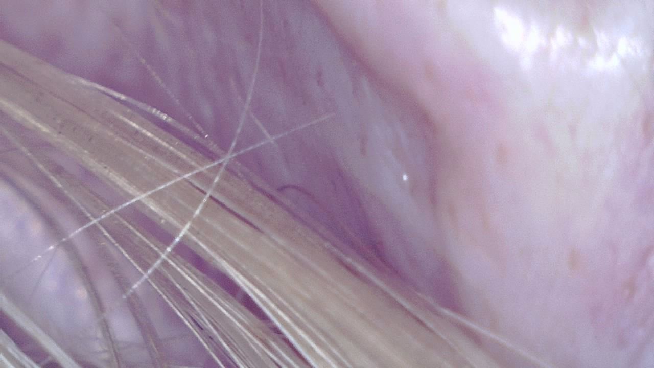 Dermatologie vétérinaire Exemple d’image microscopique 1