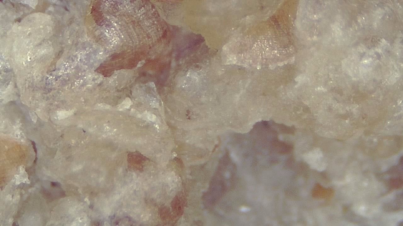 Lebensmittelindustrie Mikroskopisches Beispielbild 11