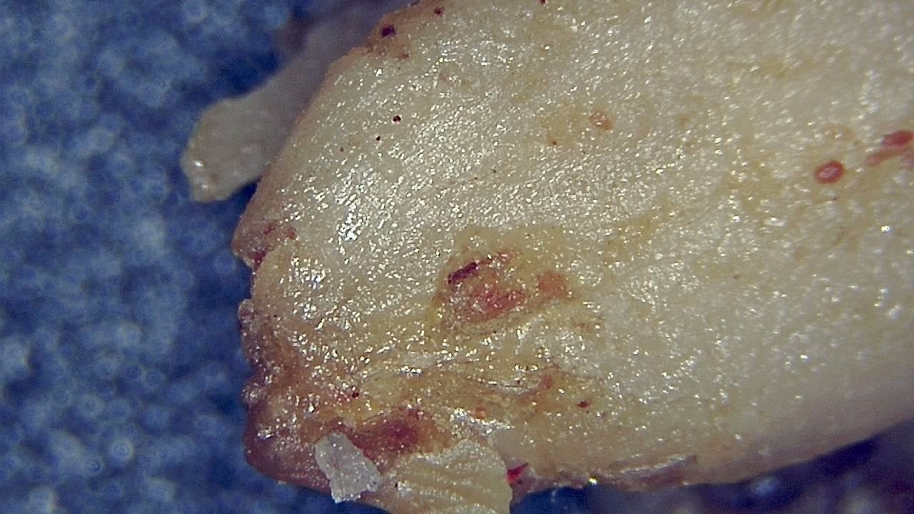Lebensmittelindustrie Mikroskopisches Beispielbild 15
