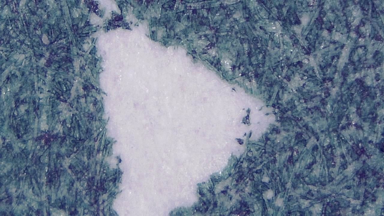 Druckinspektion und Oberflächenqualitätskontrolle Mikroskopisches Beispielbild 10