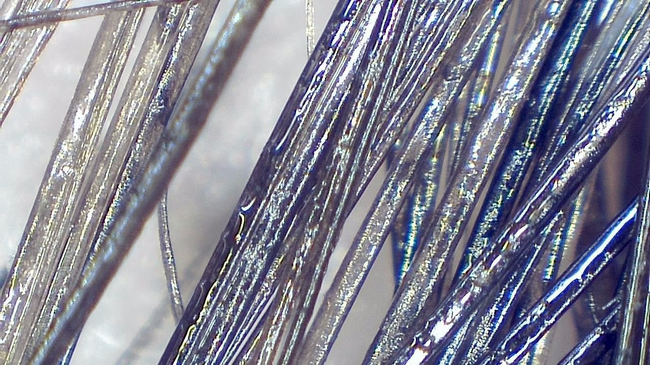 毛髪と頭皮のトリコスコープ検査 顕微鏡画像の例 6