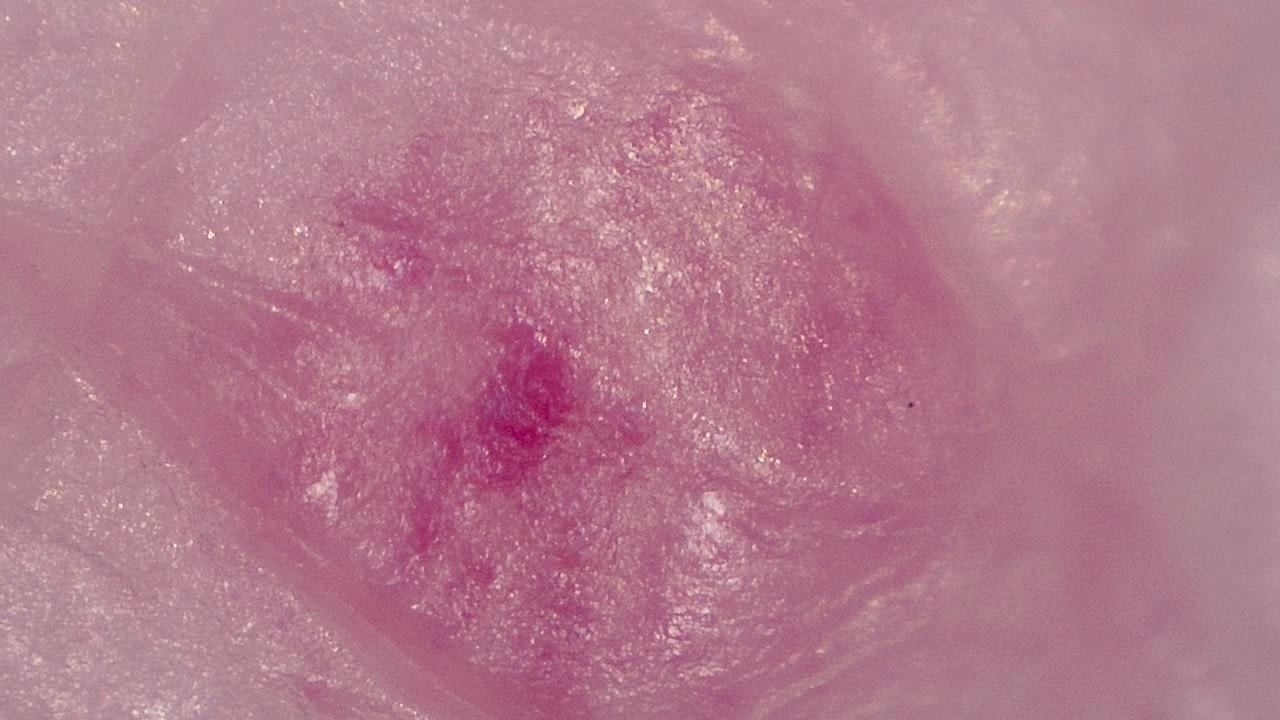 臨床皮膚科 顕微鏡画像の例 1