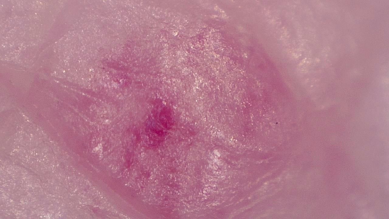 臨床皮膚科 顕微鏡画像の例 1