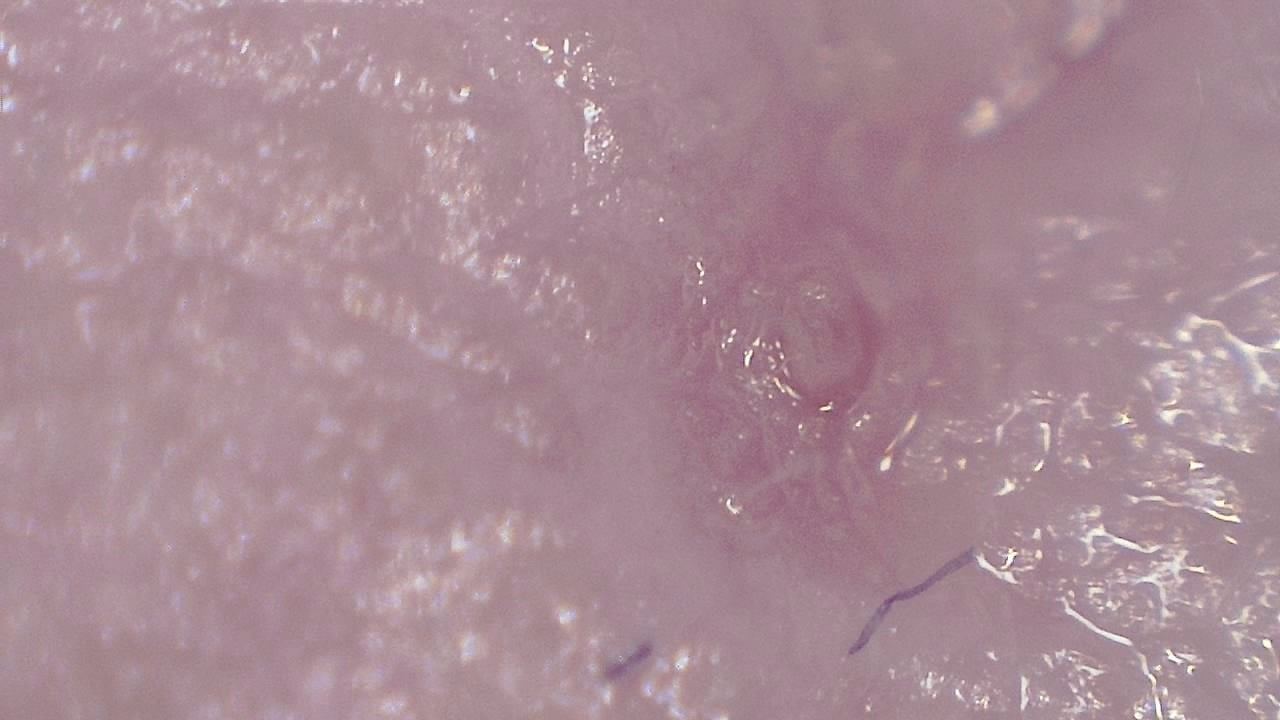 臨床皮膚科 顕微鏡画像の例 4