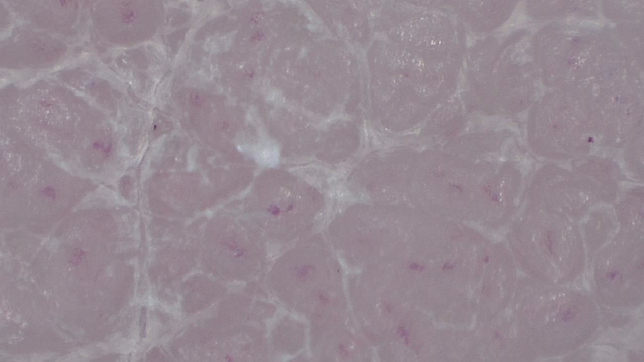 Podiatrie Exemple d’image microscopique 1