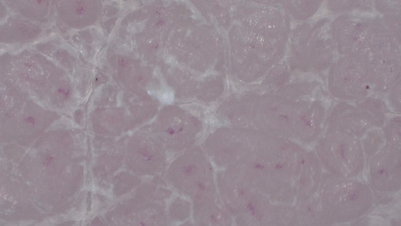 Podiatrie Exemple d’image microscopique 1