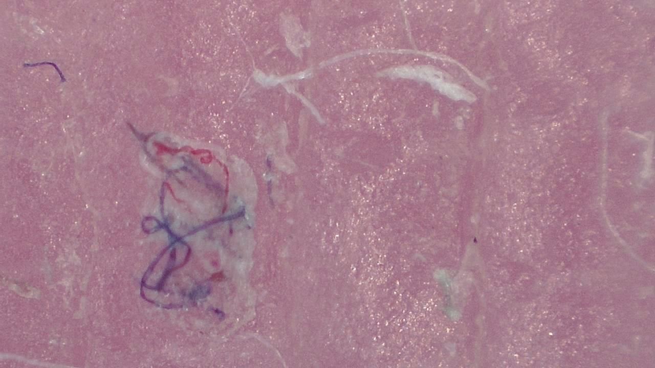 Podiatrie Exemple d’image microscopique 2