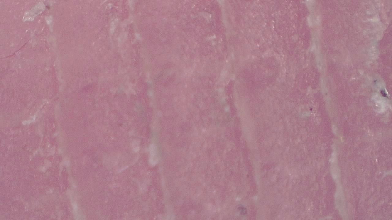 Podiatrie Exemple d’image microscopique 3