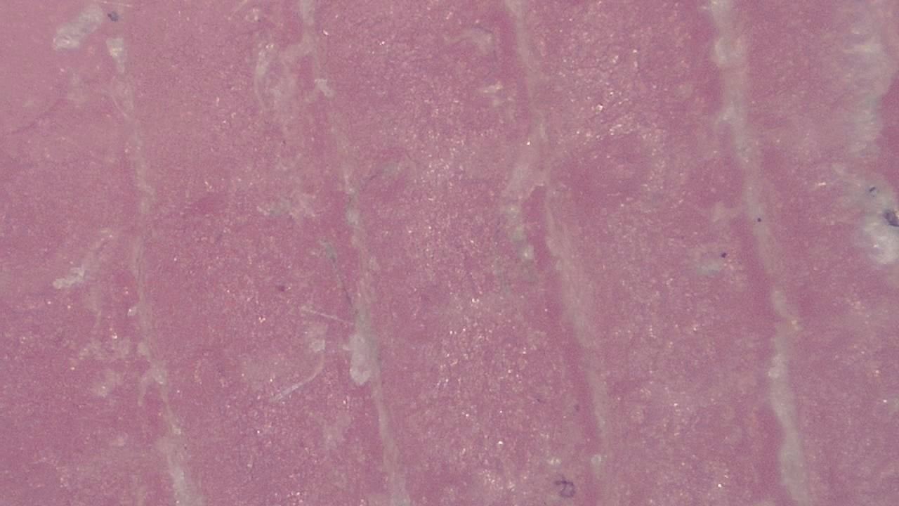 Podiatrie Exemple d’image microscopique 4