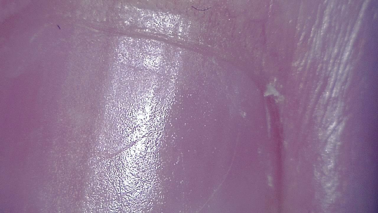 Podiatrie Exemple d’image microscopique 5