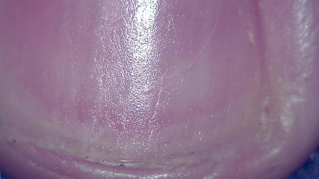 Podiatrie Exemple d’image microscopique 6