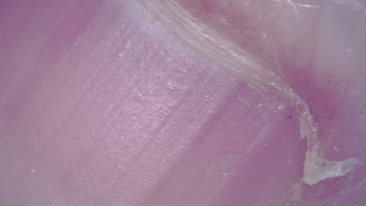 Podiatrie Exemple d’image microscopique 7