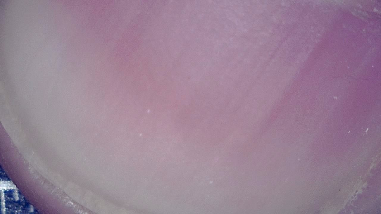 Podiatrie Exemple d’image microscopique 8