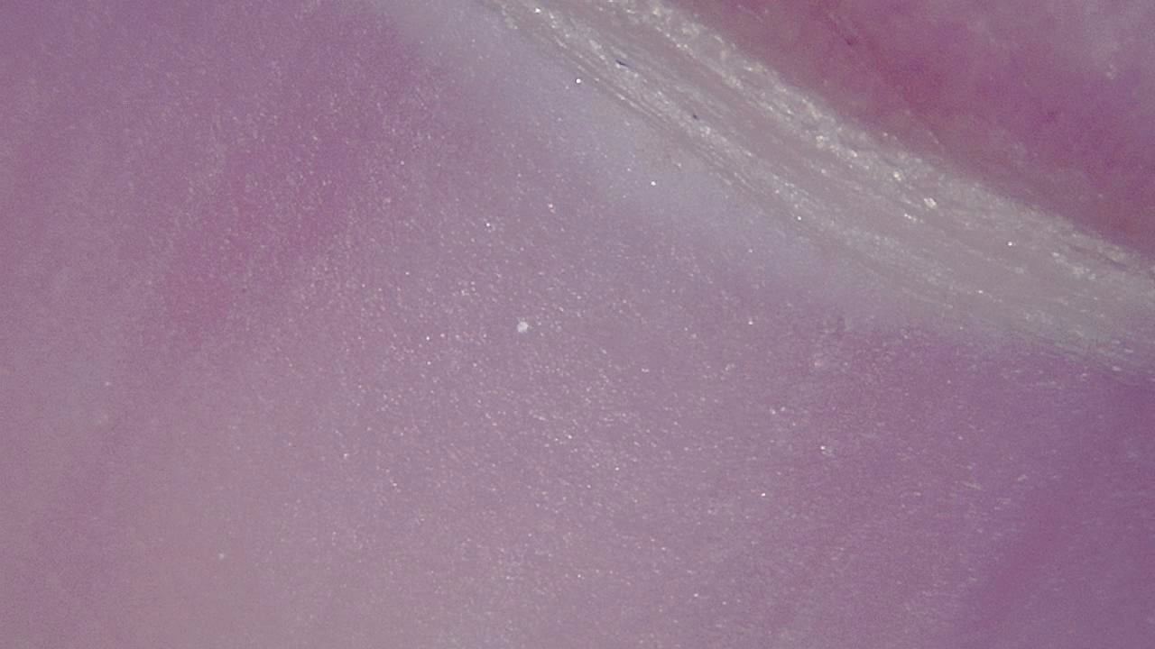 Podiatrie Exemple d’image microscopique 9