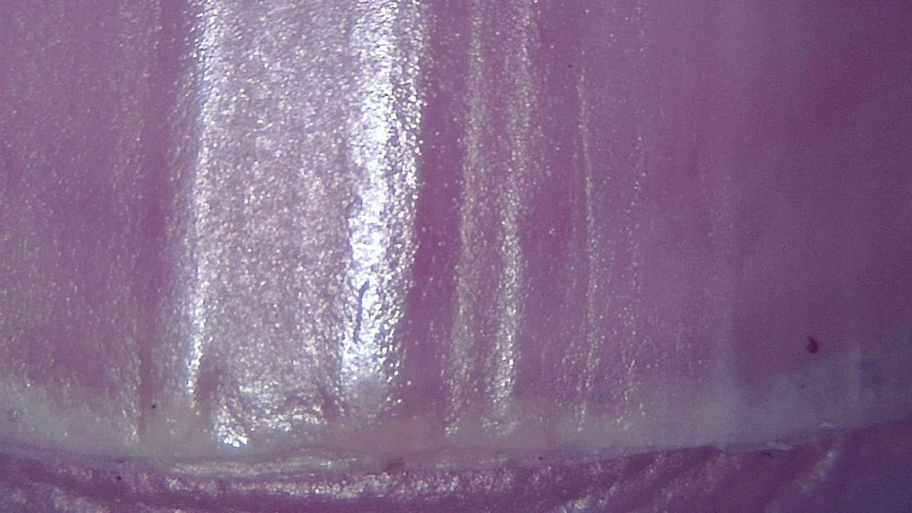 Podiatrie Exemple d’image microscopique 10