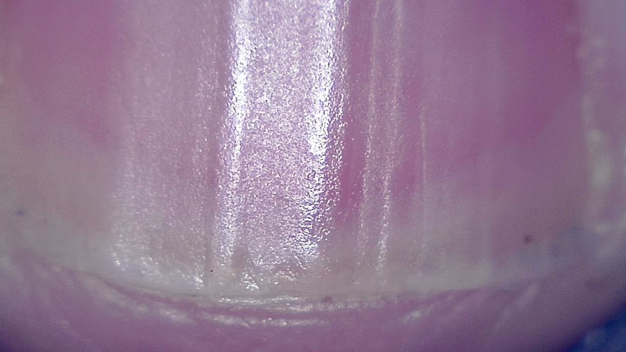 Podiatrie Exemple d’image microscopique 11